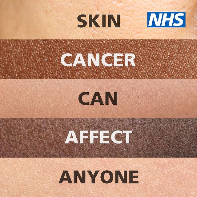 Five shades of skin colours arranged vertically in a graphic. Each tone has a word overlaying. From top to bottom, text reads: Check your skin for changes.