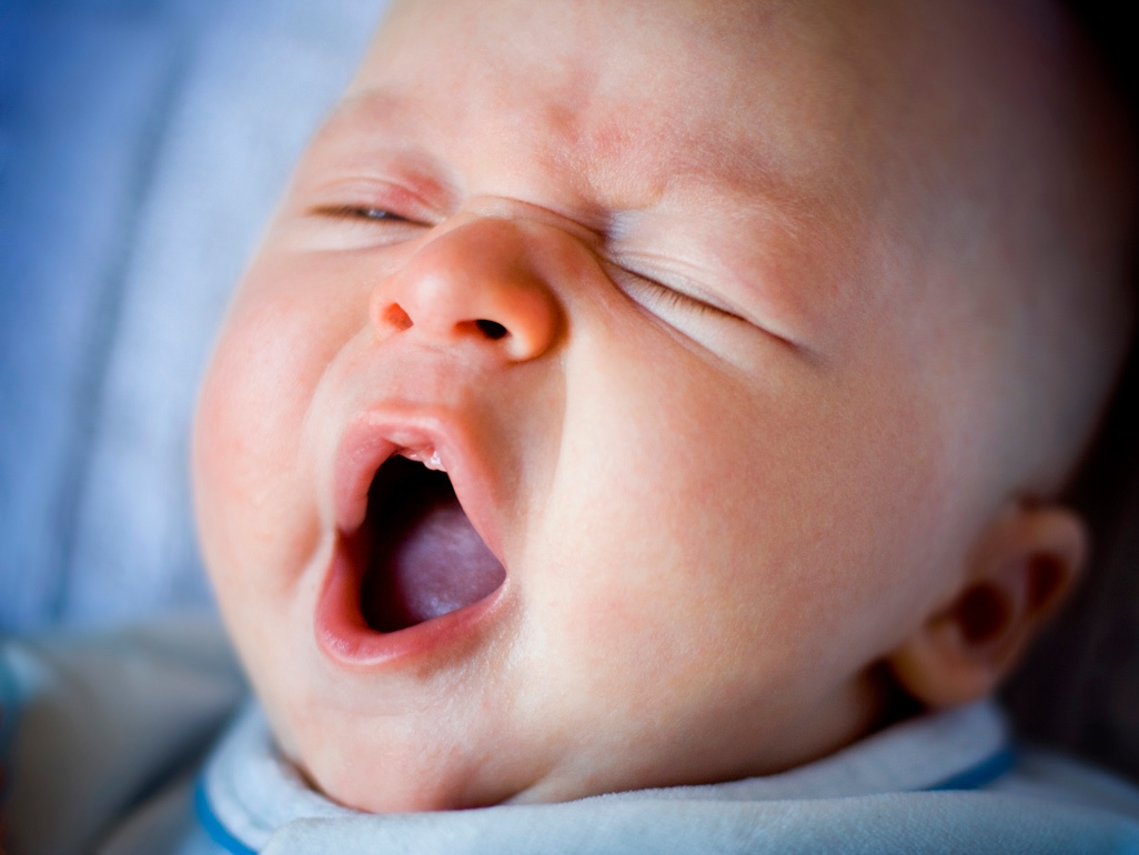 baby yawning with lip tie 