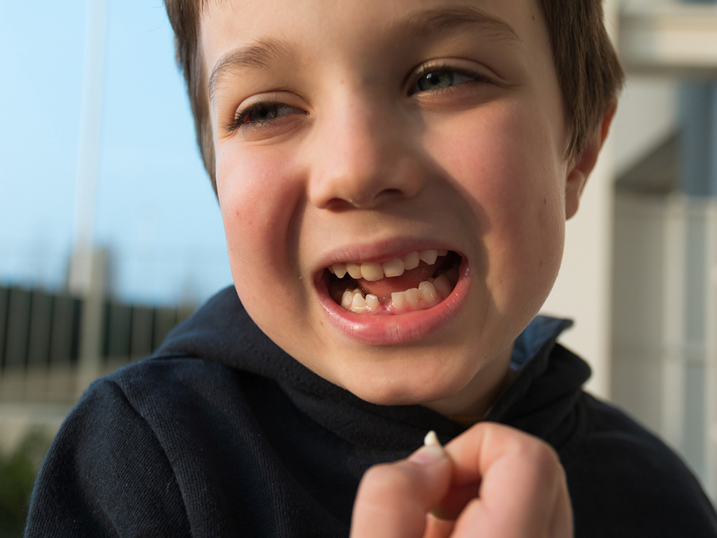 little boy with his mouth open, missing a tooth which he holds in his hand