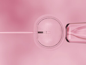 IVF procedure