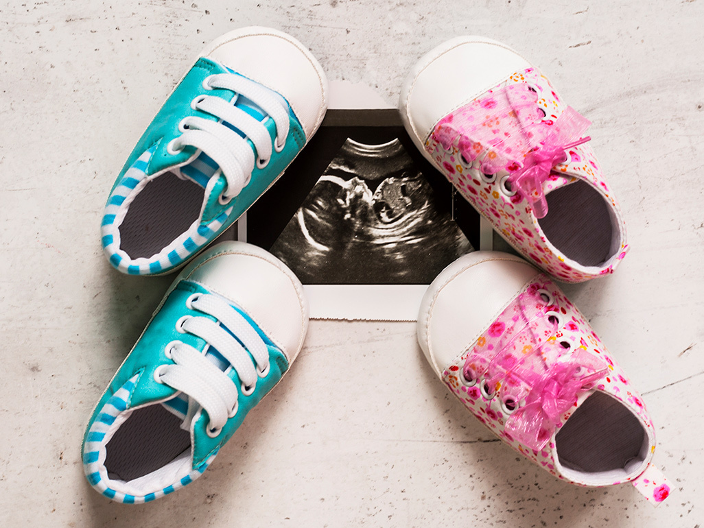 Scan photo with blue baby shoes and pink baby shoes on either side