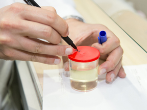 doctor marking urine sample bottle with a marker