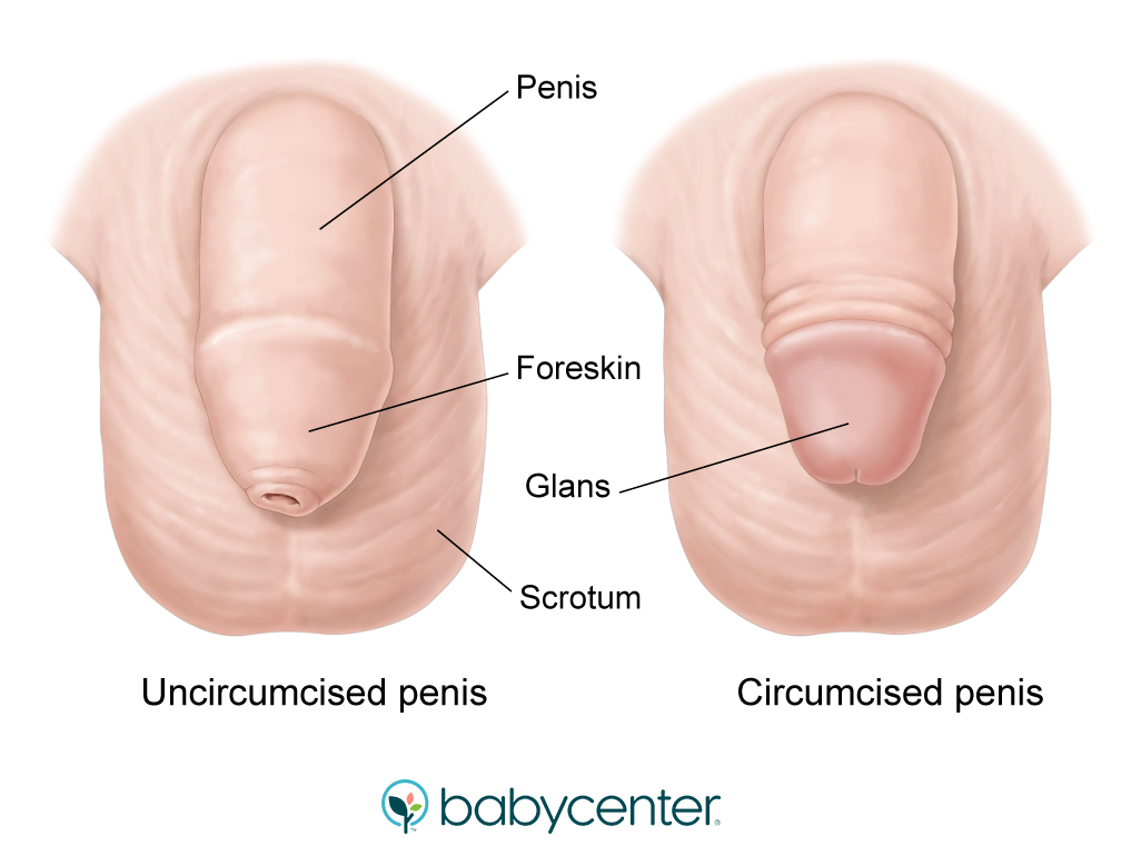 diagram of circumcised penis and uncircumcised penis