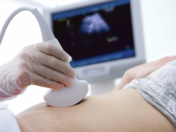 Pregnant woman getting an abdominal scan