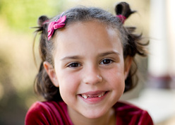 niña cambiando de dientes 