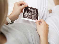 Pregnant woman looking at scan picture of her baby