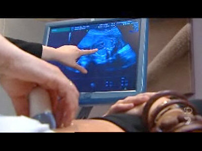 Ultrasound monitor