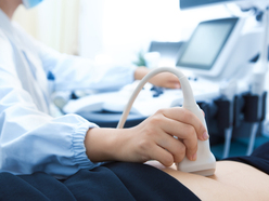 Pregnany woman in early pregnancy having her bump scanned in hospital